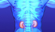 herbal Kidney Stones treatments